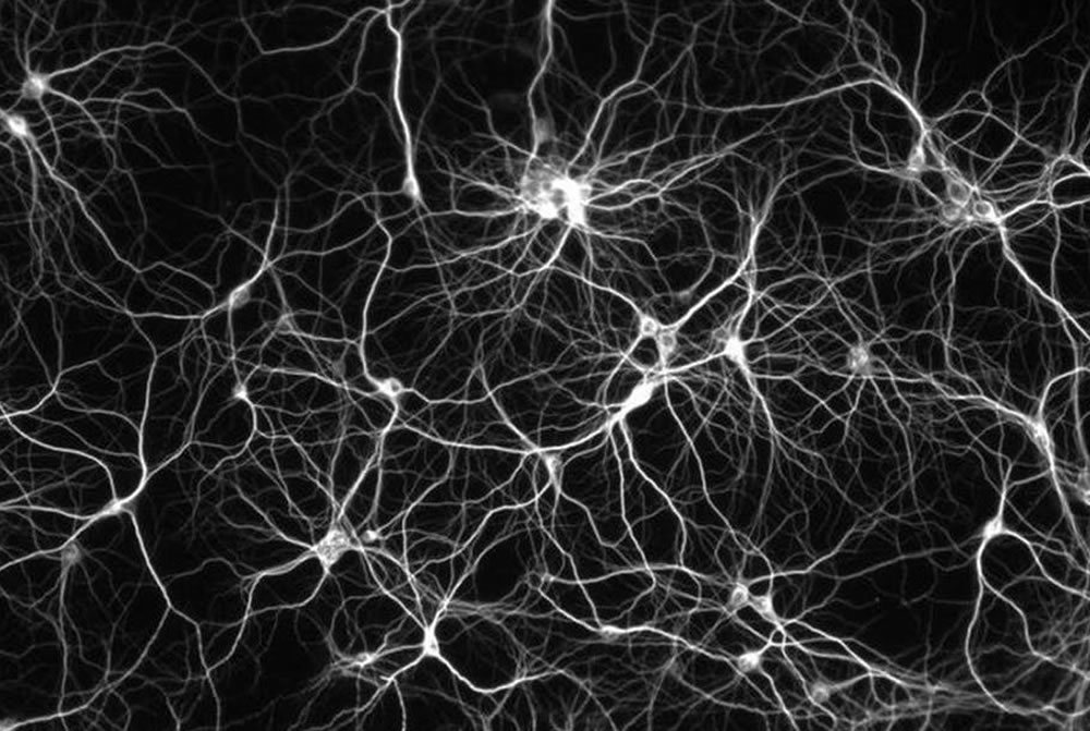 Introdução às Redes Neurais Artificiais