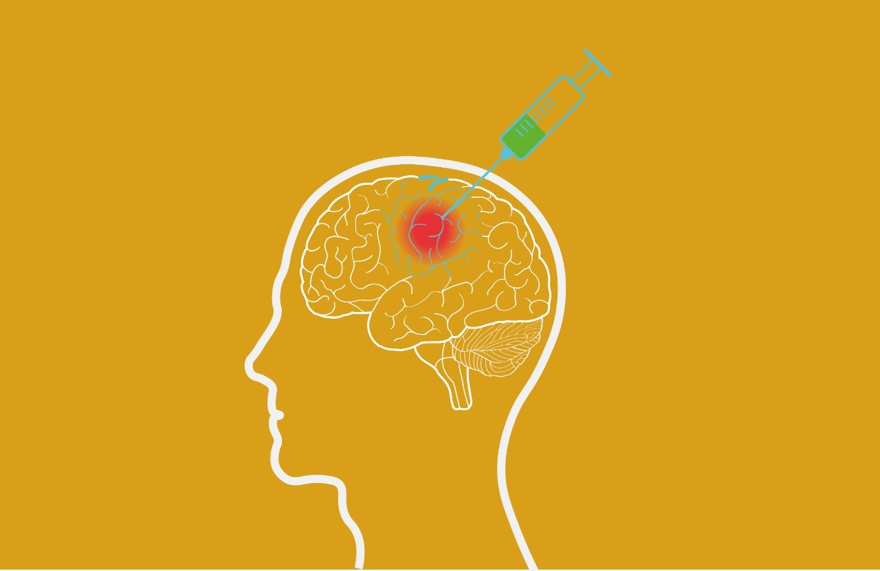 Injeção intracerebral de heme induz peroxidação lipídica, neuroinflamação e déficits sensório-motores