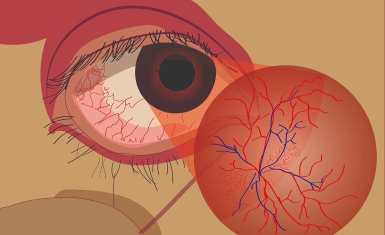 Contribuição das células de Müller no desenvolvimento da retinopatia diabética: foco no estresse oxidativo e na inflamação