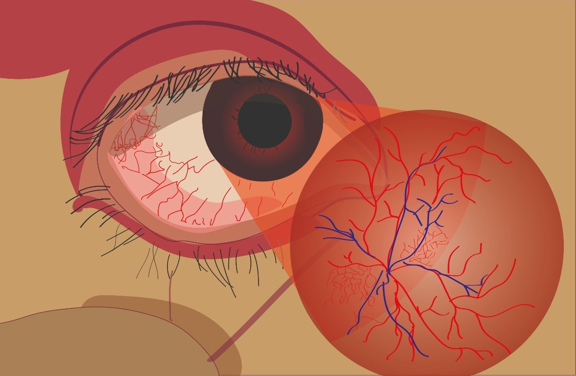 Contribuição das células de Müller no desenvolvimento da retinopatia diabética: foco no estresse oxidativo e na inflamação