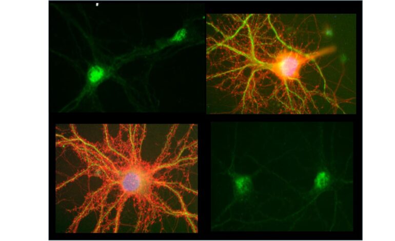 O proteassoma sináptico é inibido em modelos de doença de Alzheimer e está associado ao comprometimento da memória em camundongos
